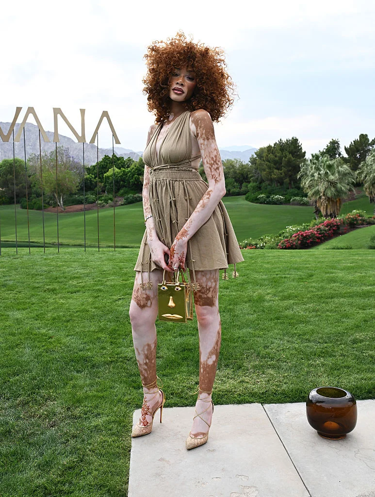 Outfit ID: Winnie Harlow 4.9.26